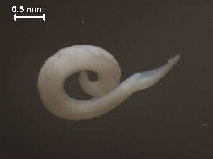  (Schistosomatidae - Sc.IN.SSO.Ld.1F.1)  @13 [ ] Copyright (2010) Sean Locke Environment Canada