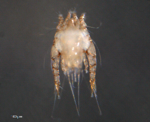  (Psoroptoididae - BIOUG15124-E05)  @14 [ ] CC-0 (2015) Biodiverisity Institute of Ontario Centre for Biodiversity Genomics