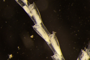  (Dendrobeania elongata - BGE_00264_B03)  @11 [ ] Creative Commons  Attribution Non-Commercial Share-Alike (2025) NTNU University Museum, Department of Natural History NTNU University Museum, Department of Natural History
