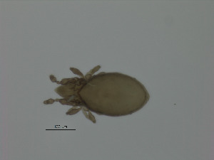  (Oppiella sp. AS2 - NFO_UIB_316)  @11 [ ] Copyright (2018) Bergen Museum Bergen Museum