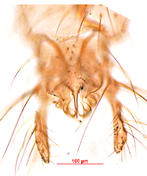  (Polypedilum bingoparadoxum - song216)  @11 [ ] Copyright (2015) Chao Song Nankai University