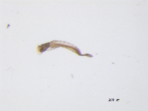  ( - BIOUG03314-F04)  @12 [ ] CreativeCommons - Attribution (2013) Trevor Bringloe Centre for Biodiversity Genomics