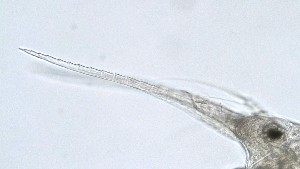  (Bosmina cf. coregoni - ZOOPS_0166)  @11 [ ] CreativeCommons - Attribution Non-Commercial No Derivatives (2018) Joe Connolly Cornell University