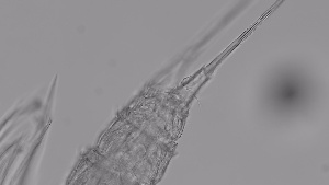  (Canthocamptus staphylinoides - ZOOPS_0307)  @11 [ ] CreativeCommons - Attribution Non-Commercial No Derivatives (2019) Joe Connolly Cornell University