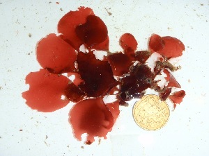  ( - GWS034872)  @11 [ ] Unspecified (default): All Rights Reserved  Unspecified Unspecified