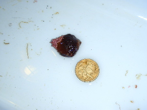  ( - GWS040337)  @11 [ ] Unspecified (default): All Rights Reserved  Unspecified Unspecified