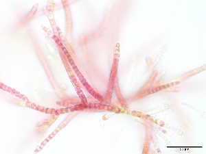  (Acrochaetium humile - CCAP135012)  @11 [ ] Unspecified (default): All Rights Reserved  Unspecified Unspecified