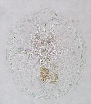  (Testudinella patina f. intermedia - ECOCHZ-AG0731)  @13 [ ] Unspecified (default): All Rights Reserved  Unspecified Unspecified