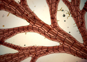  ( - PTM2357)  @11 [ ] CreativeCommons Attribution Non-Commercial No Derivatives (2024) Patrick Martone University of British Columbia