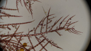  ( - BHAK-13287)  @11 [ ] CreativeCommons Attribution Non-Commercial No Derivatives (2024) Sandra Lindstrom University of British Columbia