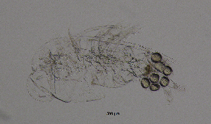  (Acanthodiaptomus - BarCrust 196)  @11 [ ] CreativeCommons - Attribution Non-Commercial Share-Alike (2015) A. Hobæk Norwegian Institute for Water Research