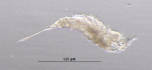  (Onychocamptus - BarCrust 327)  @11 [ ] CreativeCommons - Attribution Non-Commercial Share-Alike (2015) A. Hobæk Norwegian Institute for Water Research