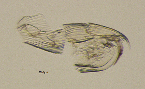  ( - BarCrust 37)  @11 [ ] CreativeCommons - Attribution Non-Commercial Share-Alike (2015) A. Hobæk Norwegian Institute for Water Research