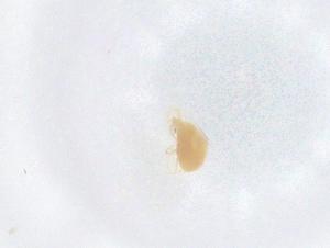  (Tetranychus mexicanus - CBG-B02123-F04)  @11 [ ] CreativeCommons - Attribution Share - Alike (2025) Centre for Biodiversity Genomics Centre for Biodiversity Genomics