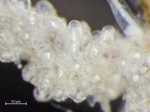  (Celleporella - HMSC174-03561)  @11 [ ] by-nc-sa  Unspecified Huntsman Marine Science Centre