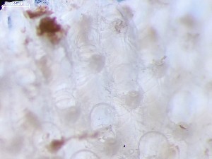  (Porella - HMSC174_03310)  @11 [ ] CreativeCommons - Attribution Share-Alike (2025) Unspecified Huntsman Marine Science Centre