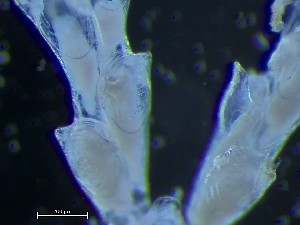  (Aquiloniella paenulata - HMSC174_04009)  @11 [ ] CreativeCommons - Attribution Share-Alike (2025) Unspecified Huntsman Marine Science Centre