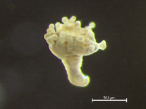 (Haliclystus - HMSC174-00651)  @11 [ ] by-nc-sa  Unspecified Huntsman Marine Science Centre