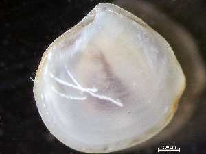  (Thyasira gouldii - HMSC174_04391)  @11 [ ] by-nc-sa  Unspecified Huntsman Marine Science Centre