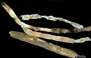  ( - HMSC174-04163)  @11 [ ] by-nc-sa  Unspecified Huntsman Marine Science Centre