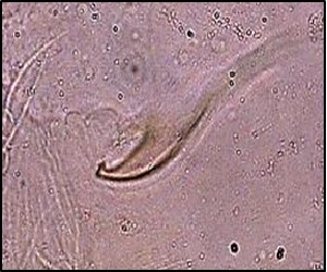  ( - BaPo2327)  @11 [ ] Copyright (2017) Arunima V Kerala Agricultural University