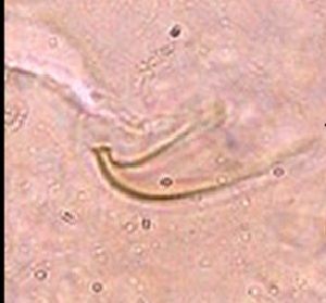  ( - BaPo2327)  @11 [ ] Copyright (2017) Arunima V Kerala Agricultural University