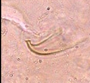  ( - BaPo2327)  @11 [ ] Copyright (2017) Arunima V Kerala Agricultural University