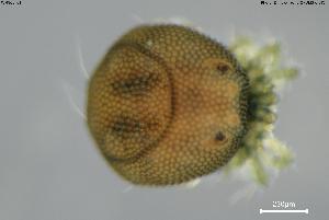  (Arrenurus leuckarti - BGE_00580_E01)  @11 [ ] Creative Commons Attribution NonCommercial ShareAlike (2023) (2024) Research Center in Biodiversity and Genetic Resources Research Center in Biodiversity and Genetic Resources