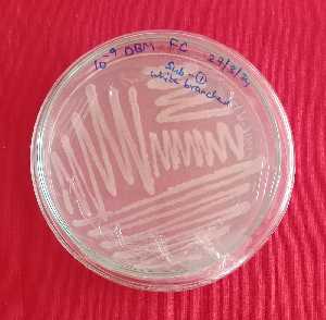 (Bacillus subtilis - PP917536)  @11 [ ] Unspecified (default): All Rights Reserved (2024) GS Panduranga ANGRAU