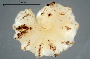  (Trachysphaera gibbula - GBOL19913)  @11 [ ] CreativeCommons  Attribution Non-Commercial Share-Alike (2017) SNSB (Staatliche Naturwissenschaftliche Sammlungen Bayerns) ZSM (Zoologische Staatssammlung Muenchen)