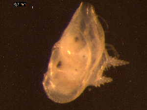  (Bythocytheridae - DSB_2728)  @11 [ ] Copyright (2015) Inga Mohrbeck German Center for Marine Biodiversity Research, Senckenberg