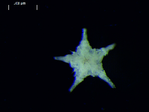  (Amphiophiura bullata - DSB_3353)  @11 [ ] Copyright (2019) Magdalini Christodoulou German Center for Marine Biodiversity Research
