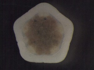  (Hyphalaster - DSB_3029)  @11 [ ] Copyright (2017) Magdalini Christodoulou German Center for Marine Biodiversity Research, Senckenberg