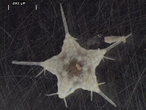  (Caulaster - DSB_2935)  @11 [ ] Copyright (2017) Magdalini Christodoulou German Center for Marine Biodiversity Research, Senckenberg