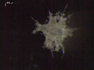  (Freyastera - DSB_3025)  @11 [ ] Copyright (2017) Magdalini Christodoulou German Center for Marine Biodiversity Research, Senckenberg