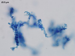 (Metarhizium anisopliae - Metarhizium anisopliae 120)  @11 [ ] CreativeCommons  Attribution Non-Commercial Share-Alike (2018) Julieta Tornesello G. Cepave, La Plata, Bs As, Argentina