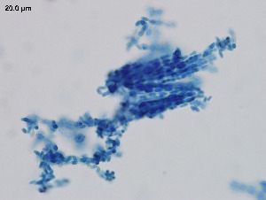  ( - Metarhizium anisopliae s.l. 160)  @11 [ ] CreativeCommons  Attribution Non-Commercial Share-Alike (2018) Julieta Tornesello G. Cepave, La Plata, Bs As, Argentina