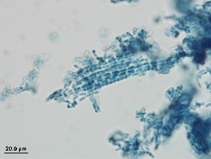  (Metarhizium robertsii - Metarhizium anisopliae 392)  @11 [ ] CreativeCommons  Attribution Non-Commercial Share-Alike (2018) Julieta Tornesello G. Cepave, La Plata, Bs As, Argentina