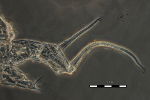  (Arctodiaptomus cf. dorsalis2 - ZPLMX892)  @11 [ ] CreativeCommons - Attribution (2018) Manuel Elias-Gutierrez El Colegio de la Frontera Sur, Unidad Chetumal