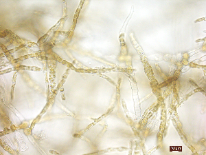  (Hecatonema maculans - FG26_ECTOCR)  @11 [ ] Creative Commons BY NC SA (2023) University of Bergen Natural History Collections