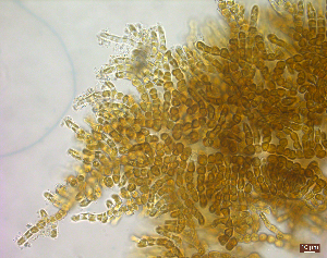  ( - FG42_ECTOCR)  @11 [ ] Creative Commons BY NC SA (2023) University of Bergen Natural History Collections