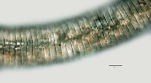  (Criconemoides sp. WI-TX - NID-N1143)  @11 [ ] CreativeCommons - Attribution Non-Commercial (2017) Tom Powers University of Nebraska