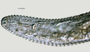  (Mesocriconema sp. HG20 - NID-N1303)  @11 [ ] CreativeCommons - Attribution Non-Commercial (2017) Tom Powers University of Nebraska