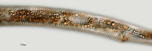  ( - NID-N1305)  @11 [ ] CreativeCommons - Attribution Non-Commercial (2017) Tom Powers University of Nebraska