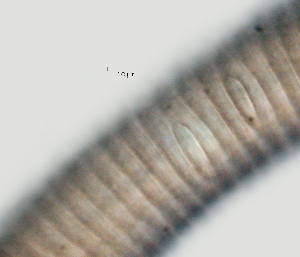  (Mesocriconema inaratum - NID-N1320)  @11 [ ] CreativeCommons - Attribution Non-Commercial (2017) Tom Powers University of Nebraska