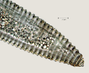  (Mesocriconema sp. K-C - NID-N1338)  @11 [ ] CreativeCommons - Attribution Non-Commercial (2017) Tom Powers University of Nebraska