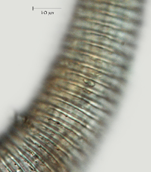  ( - NID-N2179)  @11 [ ] CreativeCommons - Attribution Non-Commercial (2017) Tom Powers University of Nebraska