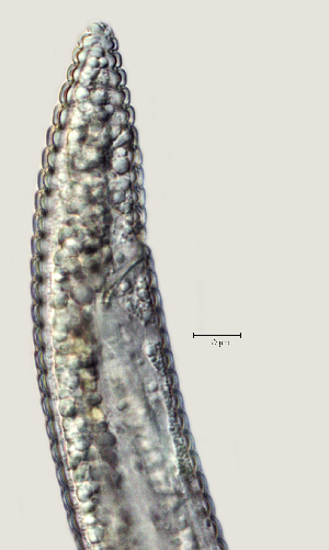  (Criconematidae - NID-N2765)  @11 [ ] CreativeCommons - Attribution Non-Commercial (2017) Tom Powers University of Nebraska