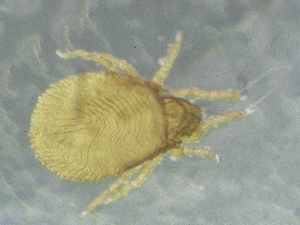  (Cymbaeremaeus inexpectatus - CcF31_2)  @11 [ ] Copyright (2018) Schäffer University of Graz, Dept. of Biology
