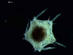  (Porcellanaster - DSB_96)  @11 [ ] Copyright (2015) Pedro Martinez Arbizu German Center for Marine Biodiversity Research